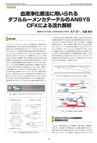 血液浄化療法に用いられるダブルルーメンカテーテルのAnsys CFXによる流れ解析