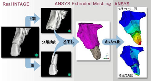 歯顎部での構造解析