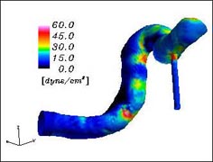 数値シミュレーションによる脳血管内流れの解析（提供：東京大学生産技術研究所）