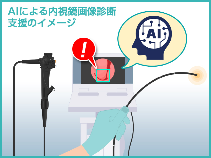 AIが大腸内の腫瘍発見をサポートする