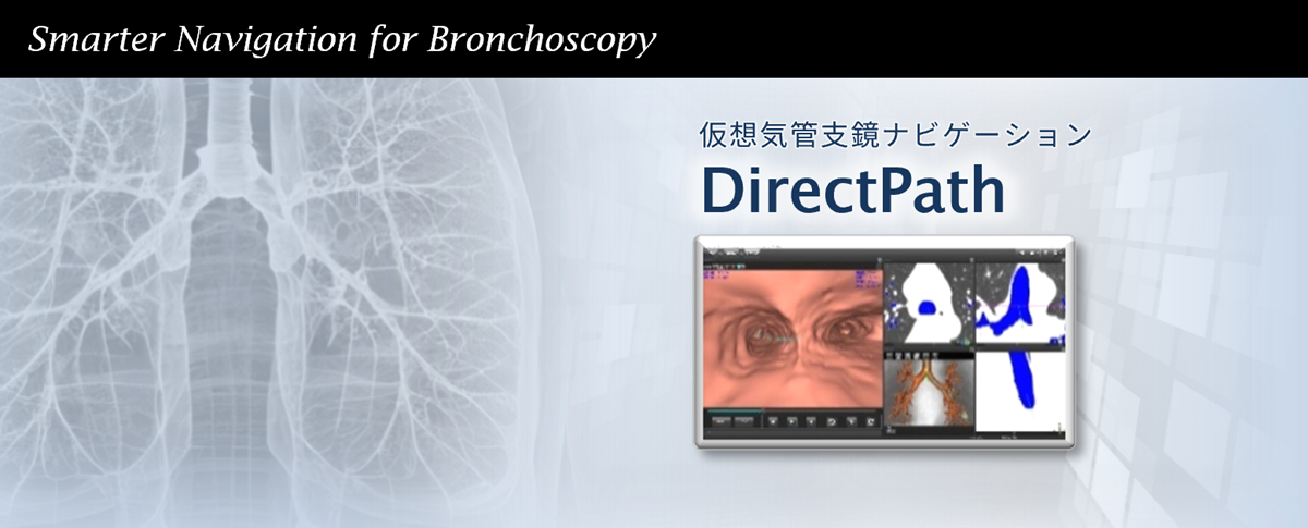 仮想気管支鏡ナビゲーション DirectPath