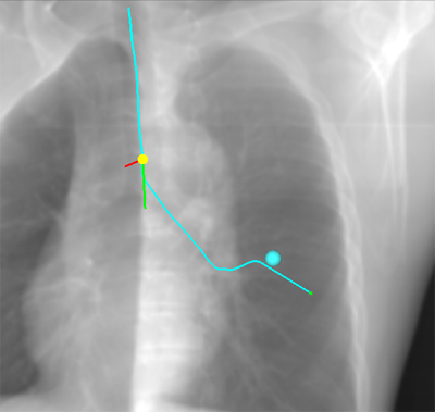 疑似 X 線画像表示機能