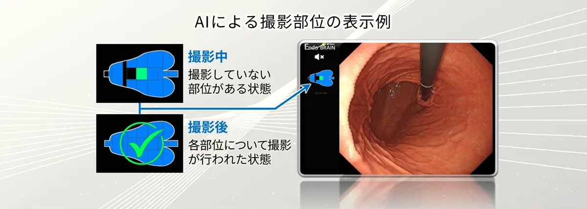 EndoBRAIN-G-Naviを利用した、AIによる撮影部位の表示例