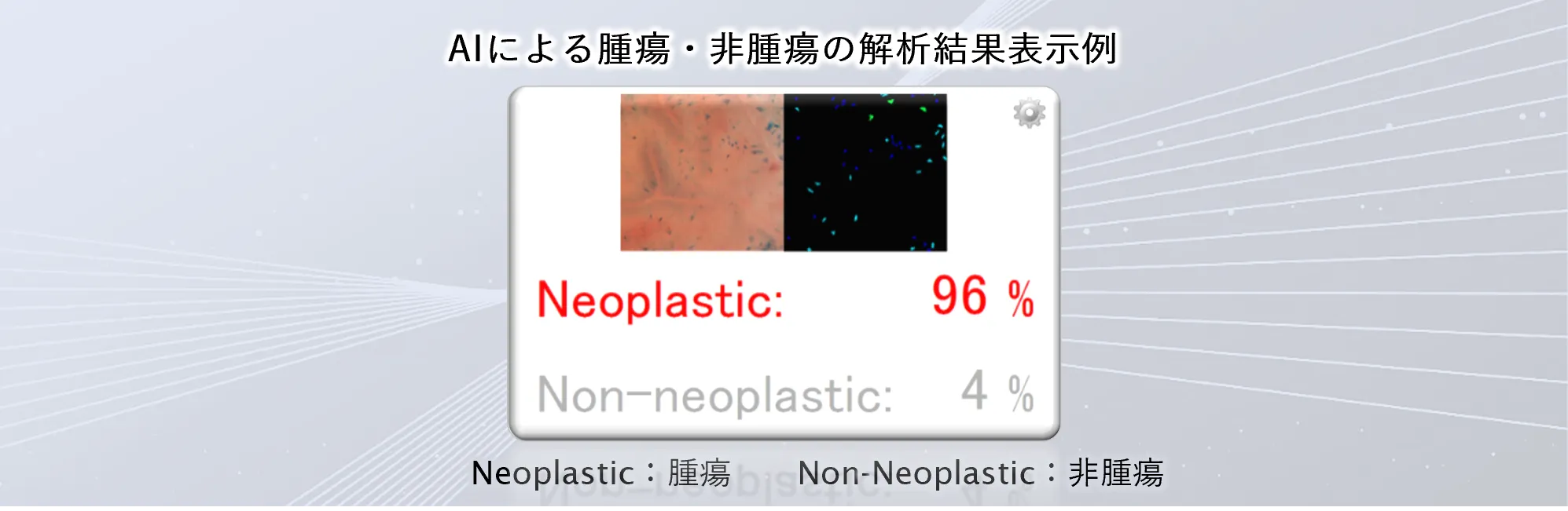 内視鏡画像診断支援ソフトウェアEndoBRAIN