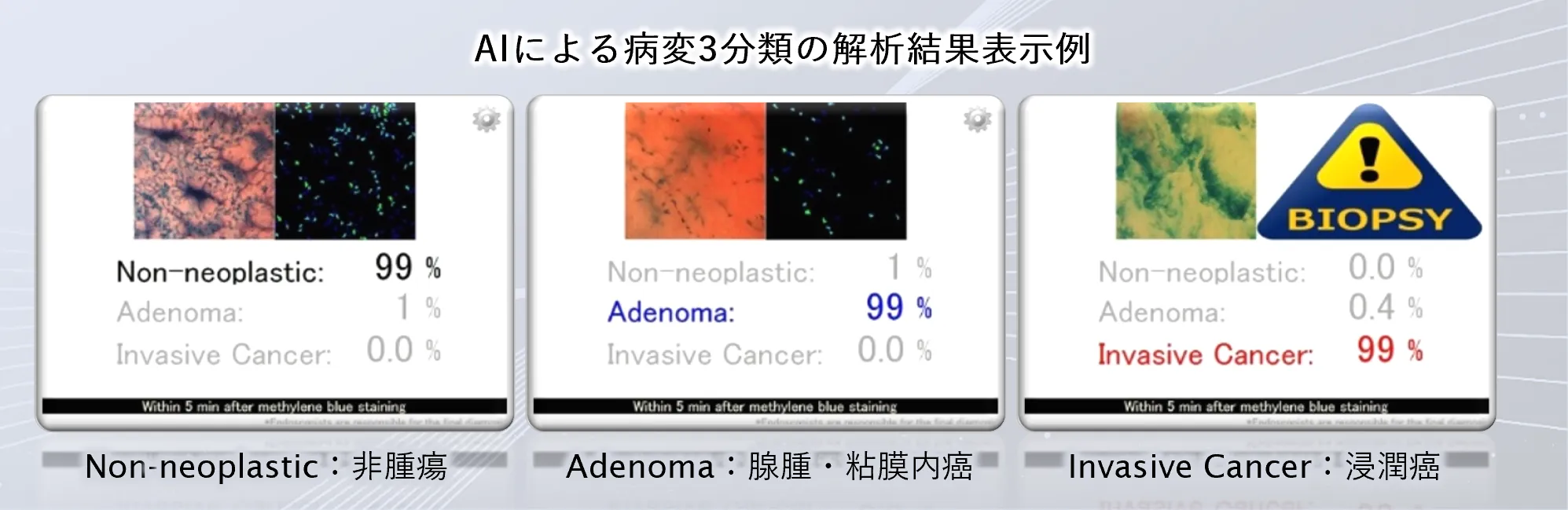 内視鏡画像診断支援ソフトウェアEndoBRAIN-Plus