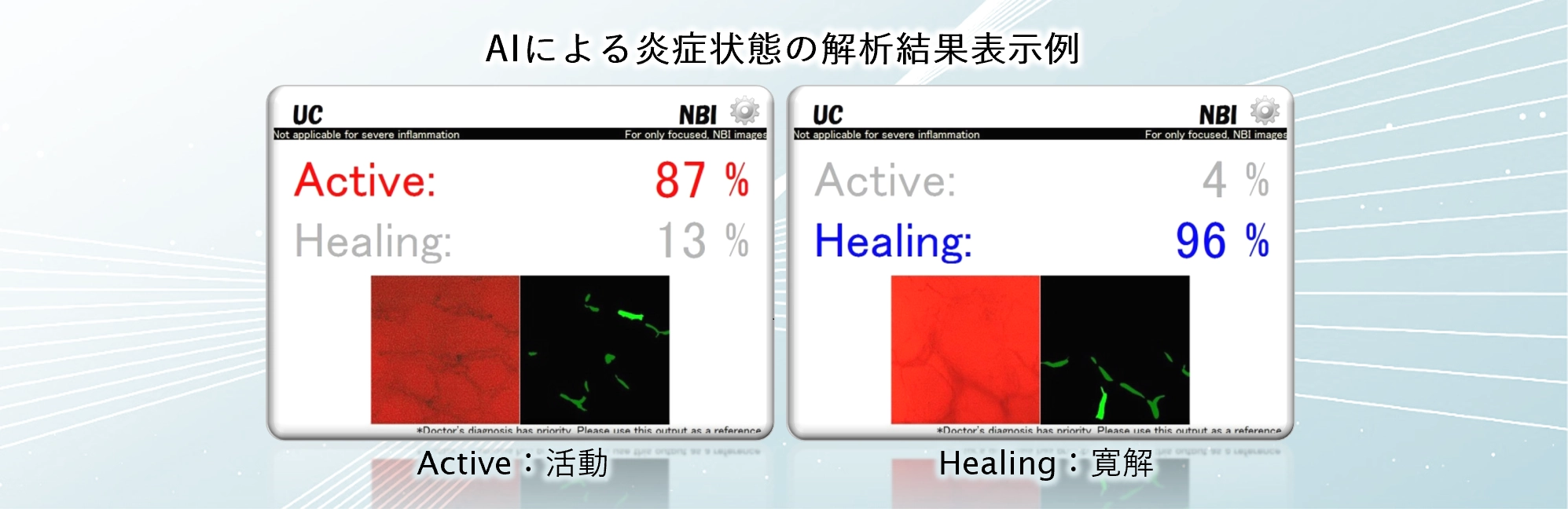 内視鏡画像診断支援ソフトウェアEndoBRAIN-UC