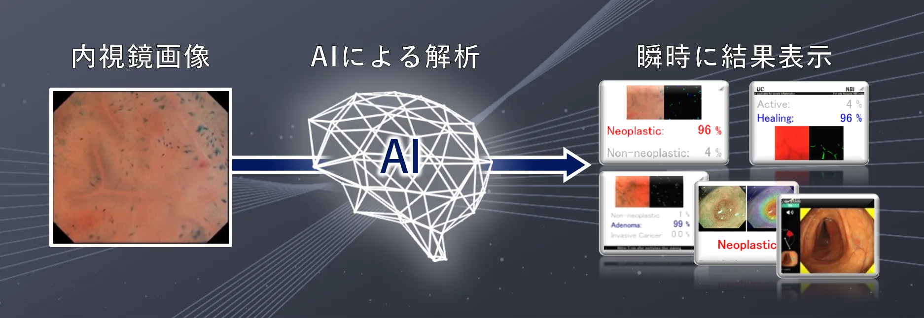 EndoBRAIN AI利用イメージ