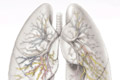 肺計測ソフトウェア　LungVision 