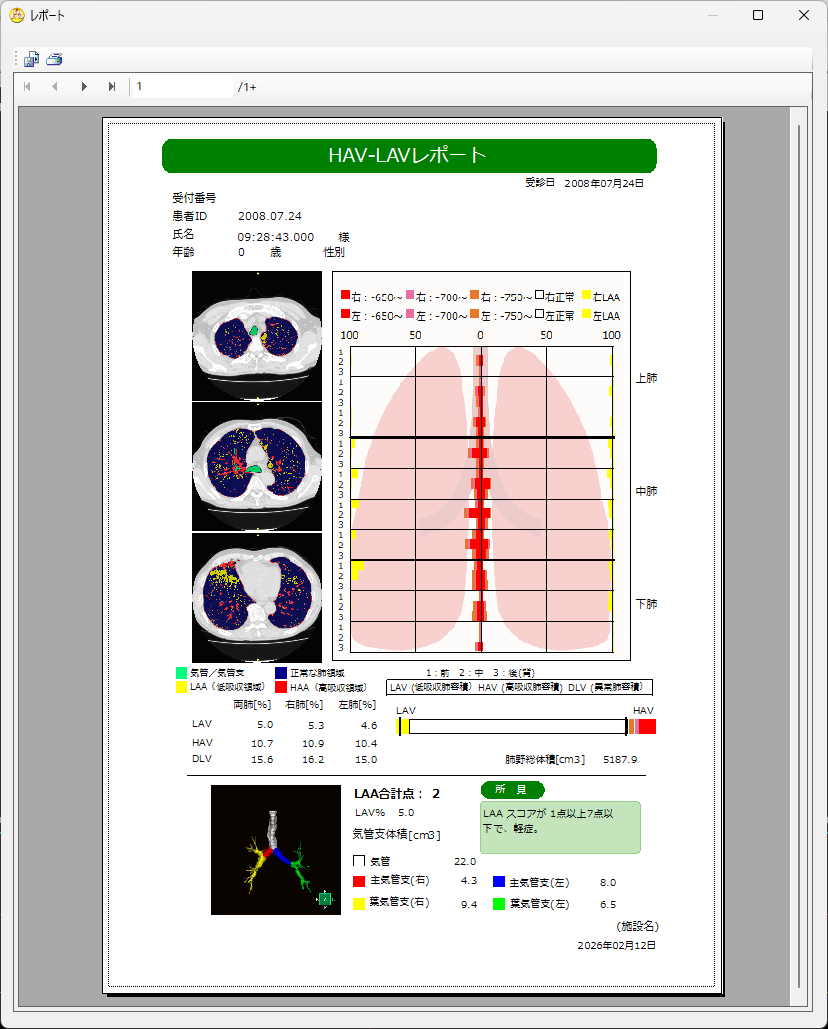 HAV-LAVレポート出力例